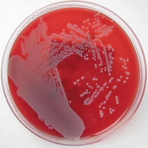 Agar krevní základ, použití a příprava / Biologie | Thpanorama - Udělej si dnes lepší!