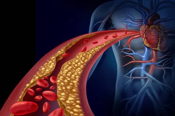 Ženy v menopauze a cholesterol | Feminus