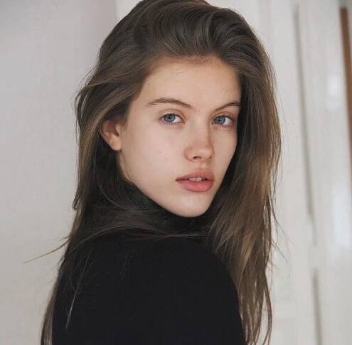 Modelka Podzimková, žena Alberta Černého: Nesnášela sama sebe! Kvůli akné