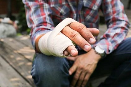 Dlaha zlomková ruka poškozená v pozadí rozostření — Stock obrázek