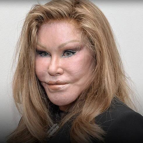 'Catwoman' Jocelyn Wildenstein Dead At 84
