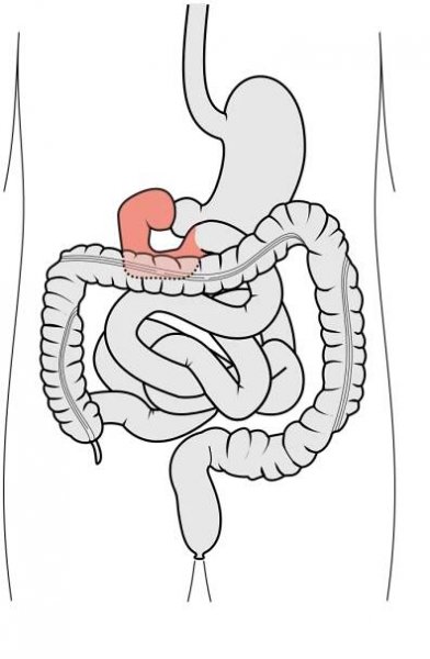 File:Tractus intestinalis duodenum.svg