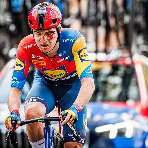 Broken hips, hands, and collarbones: Paris-Roubaix's lengthy injury list lays bare brutality of race