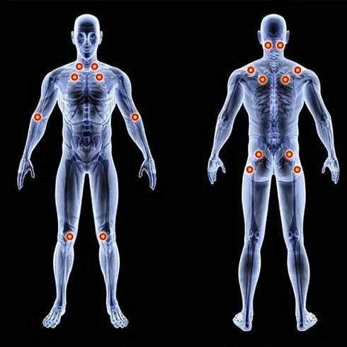 Pain Management: Signs Your Muscle Pain Is Something Else