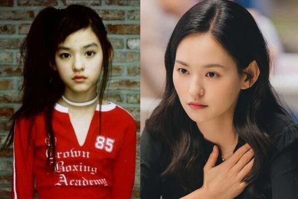 Kim Yoon-hye’s Dramatic Transformation: From Child Star to Empowered Actress After Jaw Surgery