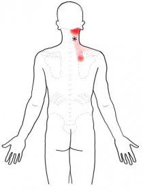 Protažení svalů na zadní straně krku | RBP zdravotní pojišťovna