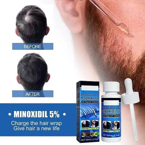PDTO Minoxidil 5% Extra Strength for Men Tekutá kúra pro obnovu růstu vlasů