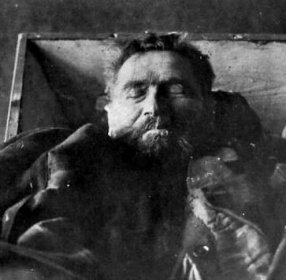 Der Kannnibale Karl Denke nach seinem Suizid am 22. Dezember 1924 im Sarg. Die Aufnahme entstand in der Gerichtsmedizin Breslau.