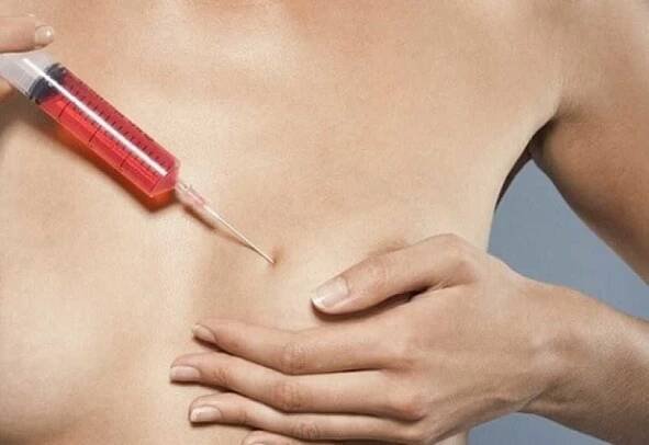 Gel pro augmentaci prsů se stal hlavním problémem plastické chirurgie. / Články