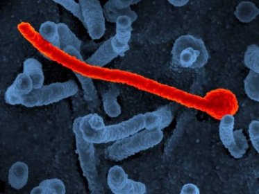 Neštovice, ebola a další. Jak vypadají nejhorší virové nákazy a co dokážou s tělem?