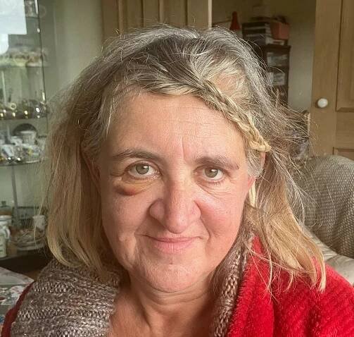 “I knew I had to go to A&E. One of the first thoughts I had was: I’ve got a brain tumour.” 