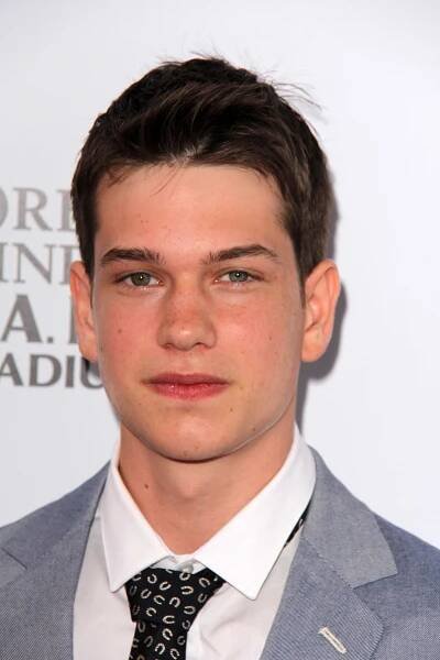 56 Celebrities With Beauty Mark (Moles)