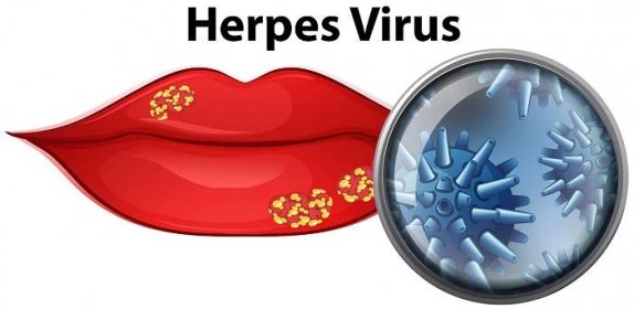 Herpes, syfilis nebo HPV?