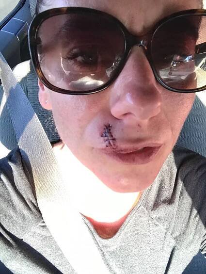 Jillian says she "felt like Frankenstein" at the time