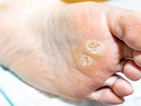 K docílení měkké a zářivé pokožky během zimy je nutné dodržovat určitá pravidla - Zdravestravovani.eu