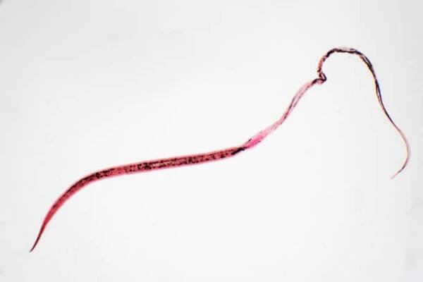 whipworm (trichuris trichiura) je parazitická helmintická nematoda (kulatá) pod mikroskopickým pohledem pro vzdělávání - roupi - stock snímky, obrázky a fotky