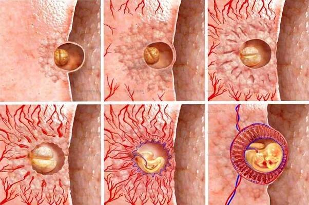 Implantace embryí po IVF / Umělá inseminace | Užitečné informace a tipy na péči o sebe. Zdraví, výživa a další.
