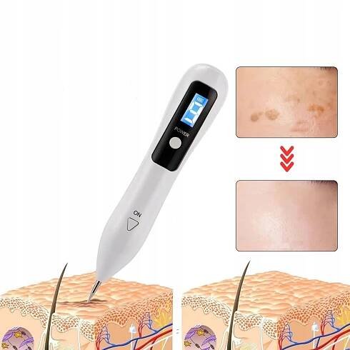 Laser Pen Plazma – odstranění tetování, jizev, bradavic, 9 nastavitelných úrovní Napětí 3.7 V
