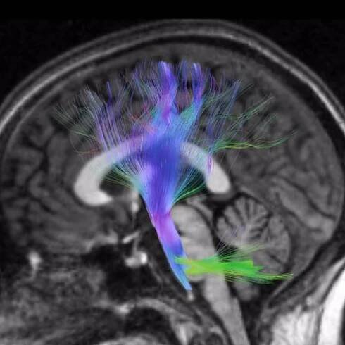 Neurotechnology Device Development | Medical Device R&D – TTP