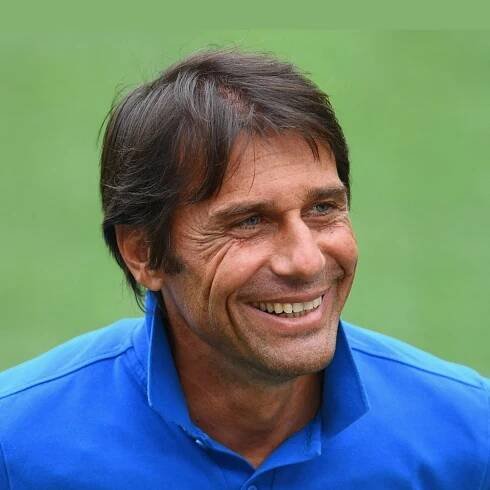Antonio Conte’s Hair Transplant: Expert Insights and Modern Techniques