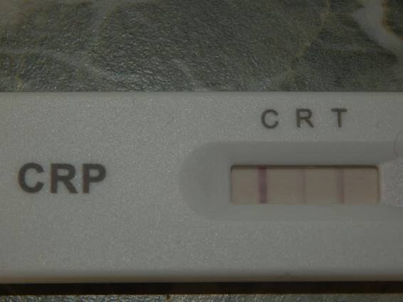 Zkušenosti domácí test CRP - Poradna pro ženy a dívky - WomenZone.cz 