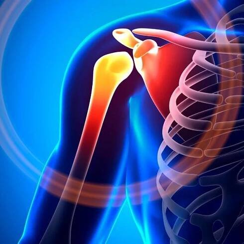 Shoulder Pain