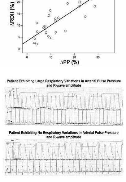 (PDF) Expression of aquaporin channels 1 and 5 during mechanical ventilation