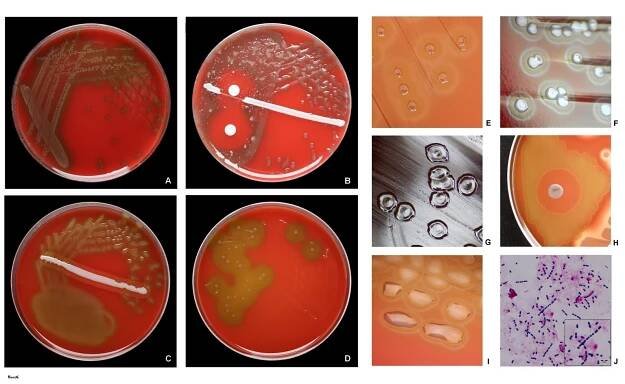 Soubor:Streptococcus pneumoniae on agar plates.jpg