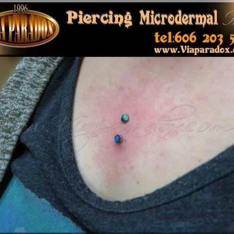 Microdermal - Via Paradox