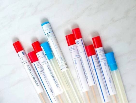 Read more about the article Chlamydia Test: Facts & What To Expect