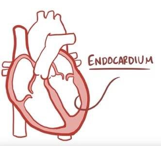 Infekční endokarditida - co je to - příznaky, příčiny a léčba