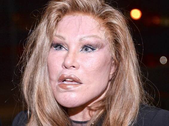 Jocelyn Wildenstein’s was the face that launched a thousand trout pouts