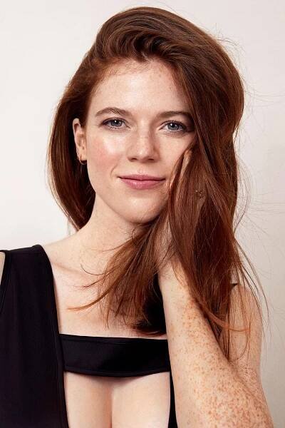 Rose Leslie – Cheek, Skin, Lip, Shoulder, Eyelash, Flash …