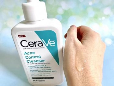 CeraVe Acne Control Cleanser bottle next to cleansing gel sample on back of hand.
