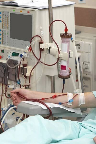 dialýza zdravotní medicína ledviny - hemodialýza - stock snímky, obrázky a fotky