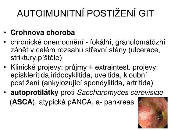 PPT - Imunodeficience a autoimunitní onemocnění PowerPoint Presentation - ID:3960798