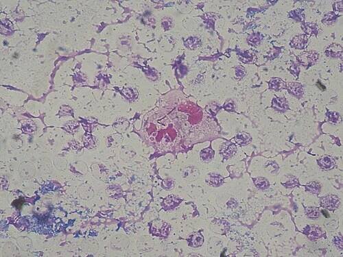 Pseudomonas aeruginosa - Wikipedia