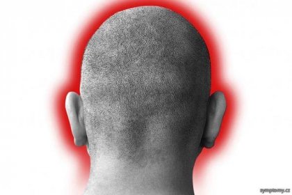 Bolest hlavy - příznaky a léčba