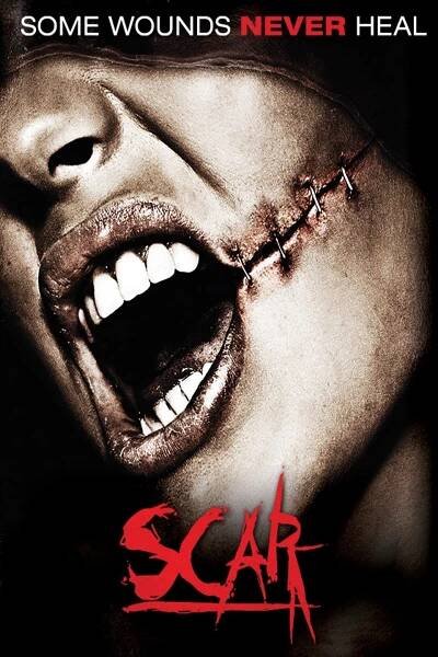 Scar
