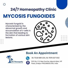 MYCOSIS FUNGOIDES homeopathy treatment in zirakpur