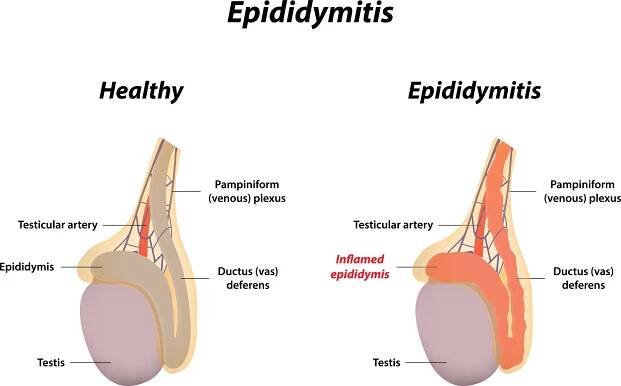 6 Anatomical Reasons For Male Infertility — Genesis Functional Wellness