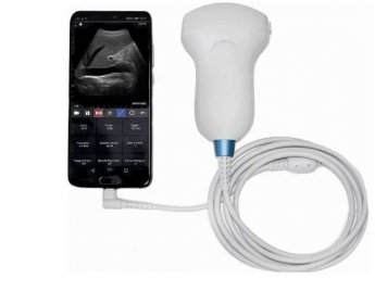 TELEMED-MicrUs-and-MicrUs-Series-Pro-Series-Ultrasound-Systems-FEATURED-IMG