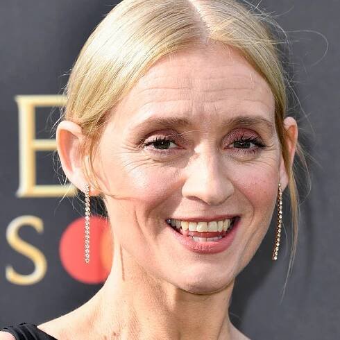 Anne-Marie Duff speaks out about decision not to get Botox: ‘Some people think it’s bonkers’