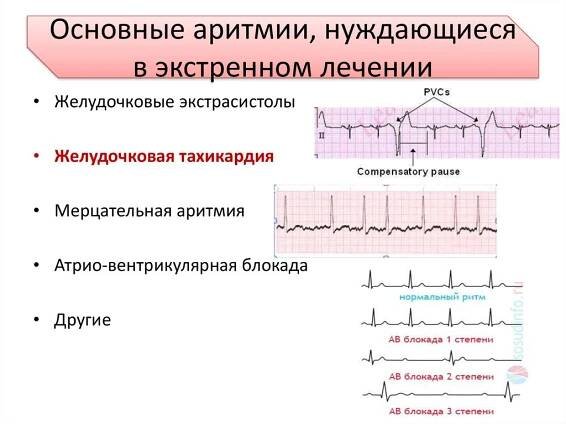 Arytmie u koček - příčiny, příznaky, diagnostika a účinná léčba