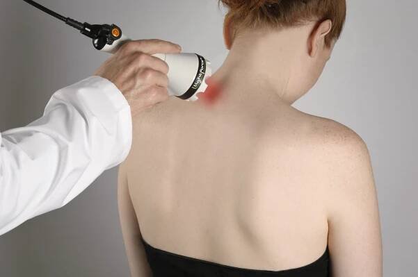 Osteochondróza krční páteře