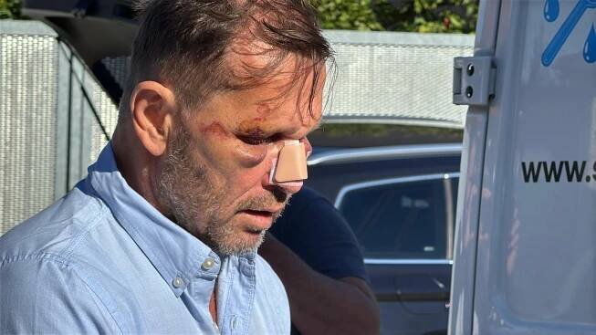 Bitka Soukupa a Agátina manžela Dopity: Podezřelý předmět na záběrech. Policie promluvila o použití boxera