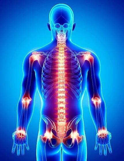 Myofascial Pain Syndrome: Causes, Symptoms, Treatment