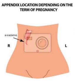 Umístění přílohy závisí na době těhotenství. 8-9 měsíců. Infografy. Vektorové ilustrace na izolované pozadí.