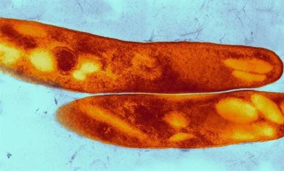 Mycobacterium tuberculosis – bakterie, která způsobuje tuberkulózu.