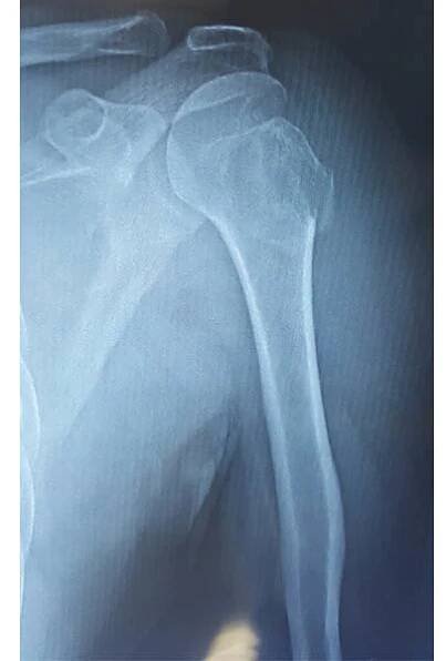 Joint line Orthopaedic Hospital